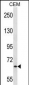 MEN1 Antibody (N-term)